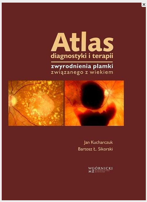 Atlas diagnostyki i terapii zwyrodnienia plamki związanego z wiekiem