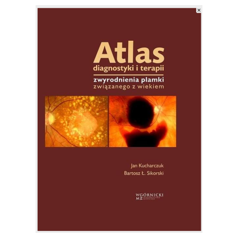 Atlas diagnostyki i terapii zwyrodnienia plamki związanego z wiekiem