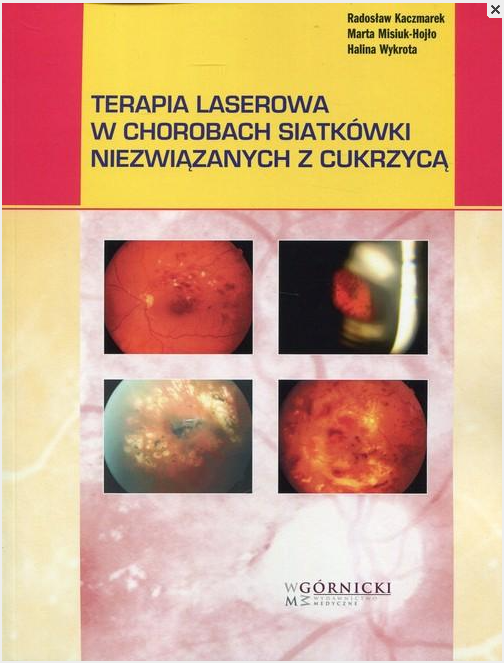 Terapia laserowa w chorobach siatkówki niezwiązanych z cukrzycą