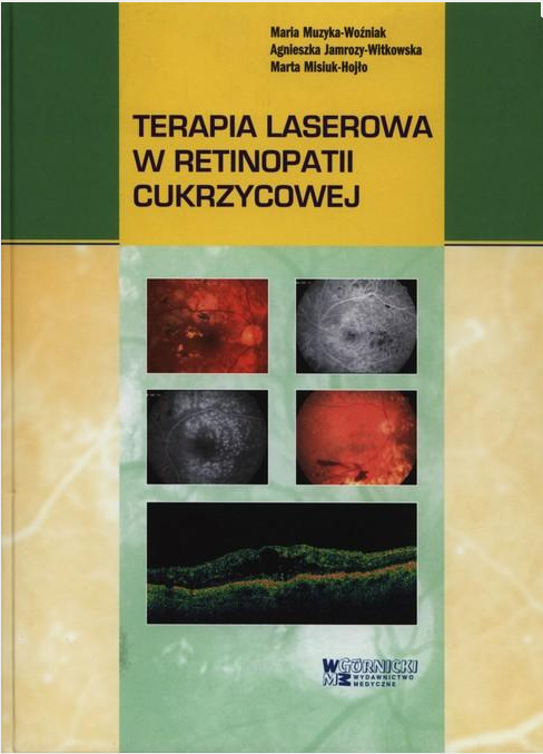 Terapia laserowa w retinopatii cukrzycowej