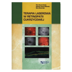 Terapia laserowa w retinopatii cukrzycowej