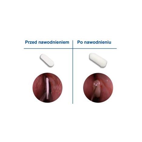 PosiSepX opatrunek donosowy z polimeru chitosanu-aminopolisacharydu, 5,1x1,5 cm, 1 szt 