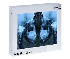 Negatoskop dentystyczny, ekran 24x30 cm CEFALOM 01